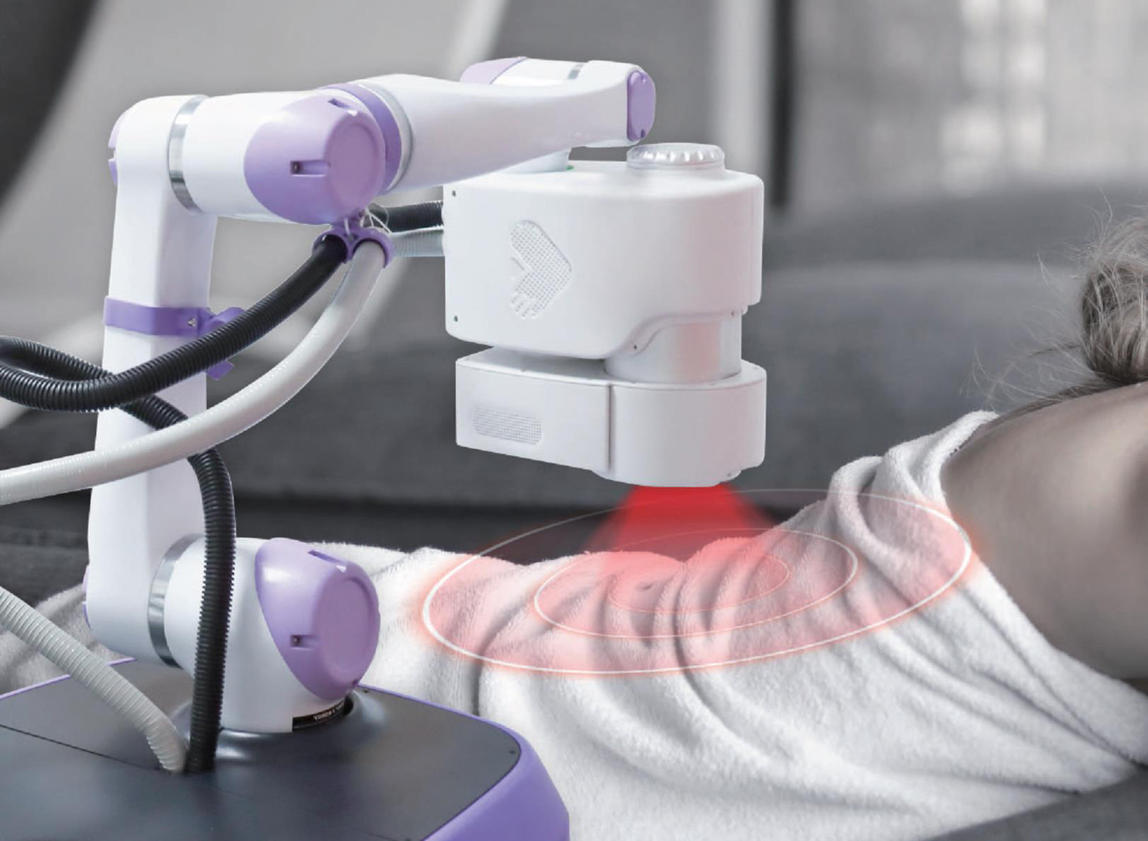 الكى الحراري_3